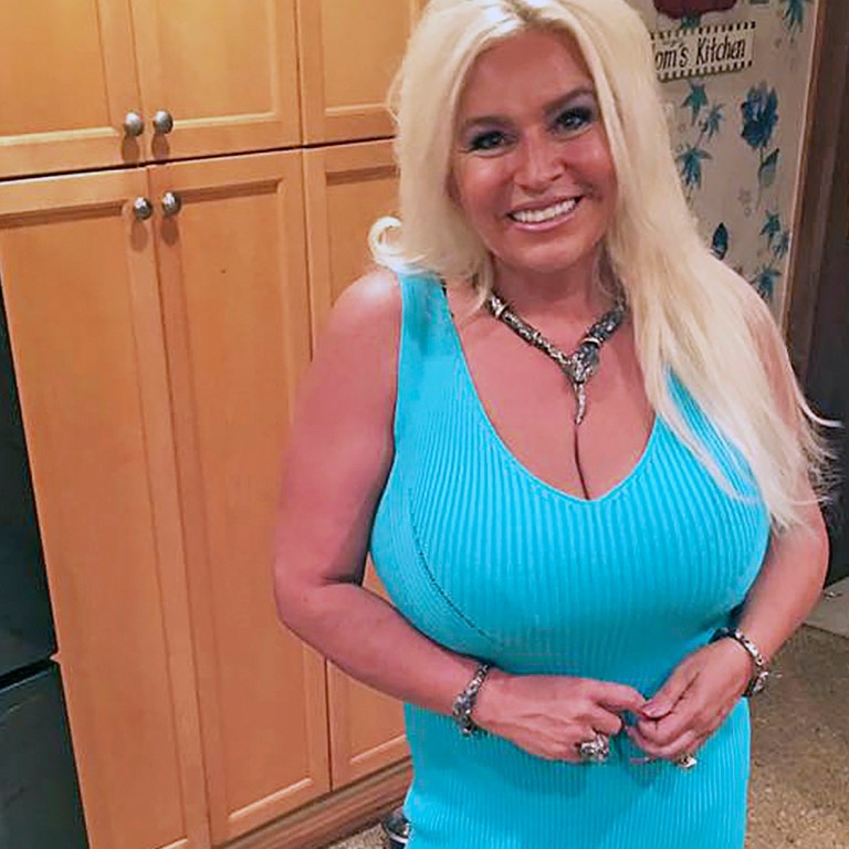 ‘Dog The Bounty Hunter’ Co-Star Beth Chapman Dies At 51
