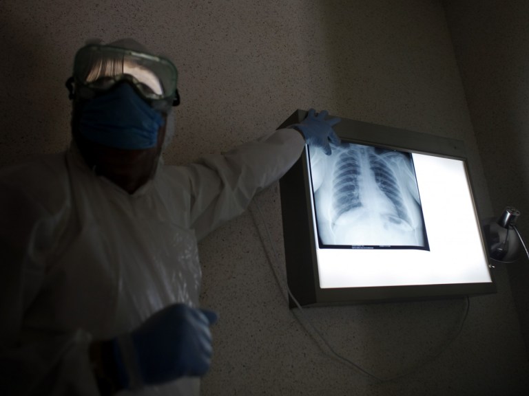 lung x-rays_AP Images