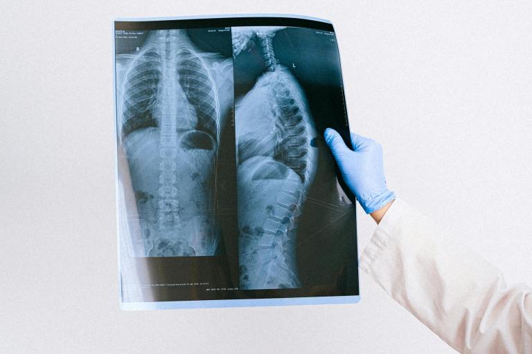 Wellness Wednesday: Are Your Lungs Healthy?