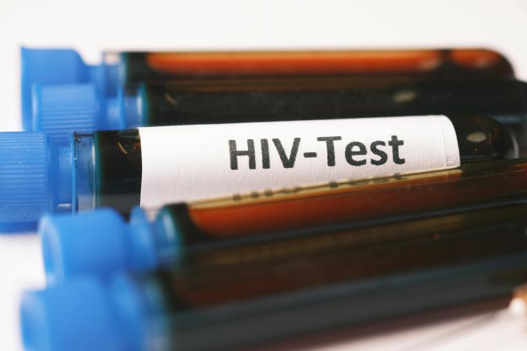 Wellness Wednesday: Update on HIV/AIDS in the DMV