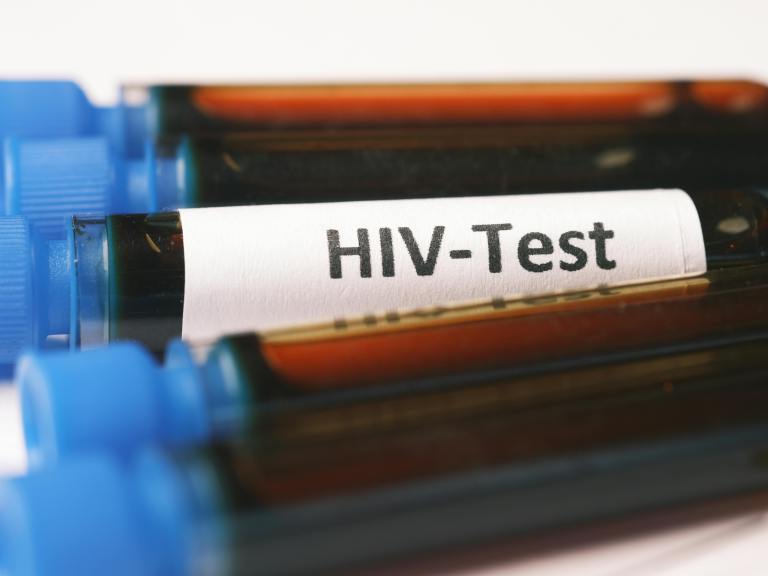 HIV TEST