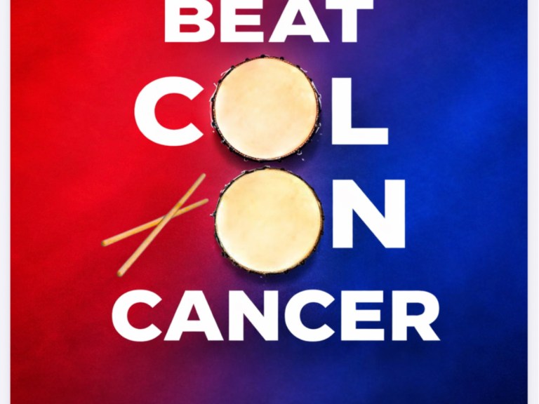 Colon Cancer Colon Cancer